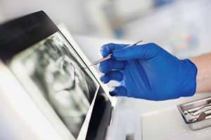 Worcester implant dentist looking at screen with dental X-rays