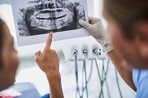 Dentist and patient looking at X-rays discussing dental implants in Worcester