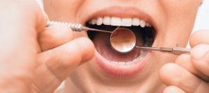 a dentist using dental tools to examine a patient’s mouth