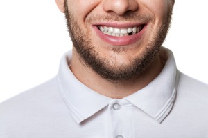 Close-up of smile with missing tooth