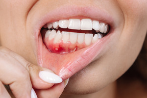 Pulling up lips to show gums