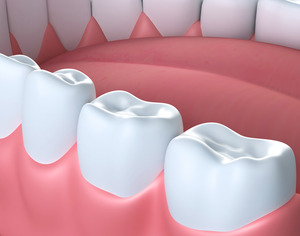 Illustration of teeth and gums in lower arch
